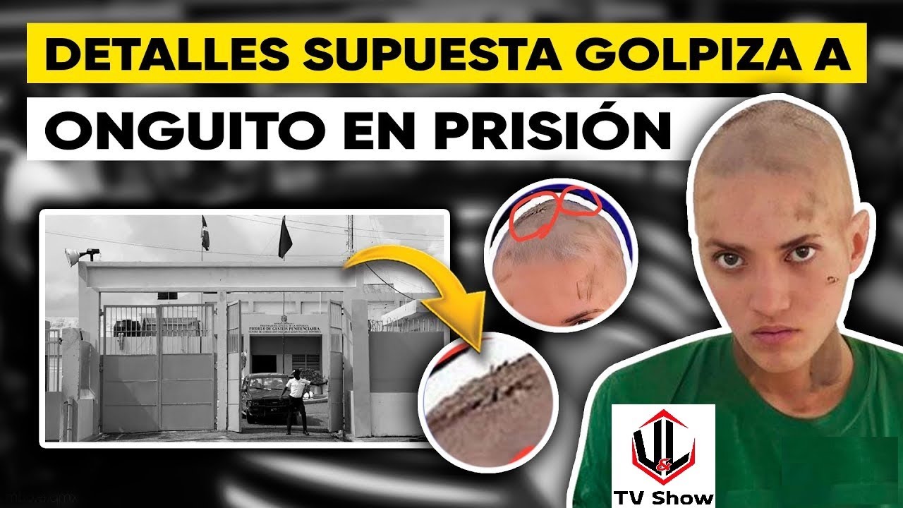 le-partieron-la-madre-a-onguito-wa-en-najayo-doctores-falsos-en-rd