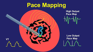 Pace Mapping:  Principles and Pitfalls