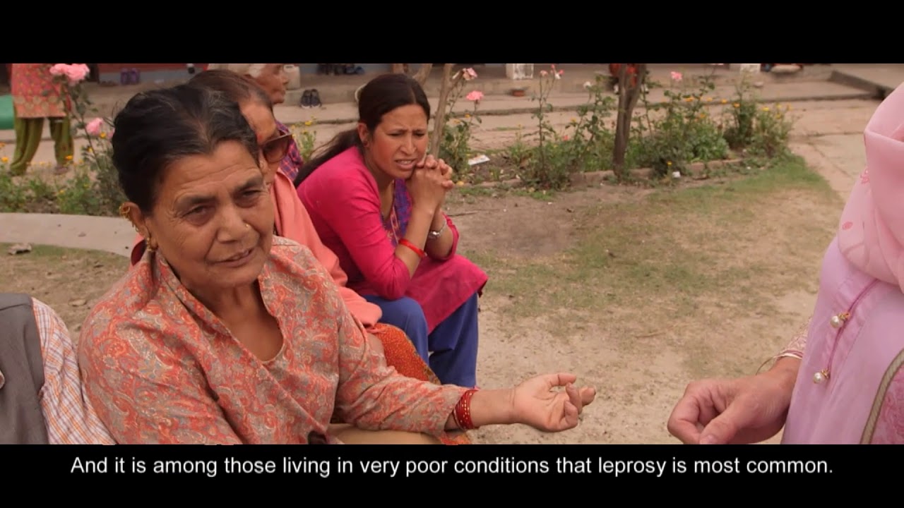 Discover 199+ leprosy slippers latest