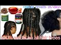 100% works like magic mix red oil clove DAX blue magic hair grease Ur hair will never stop growing