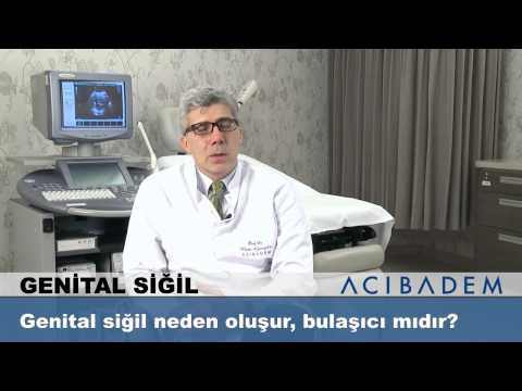 Genital siğil neden