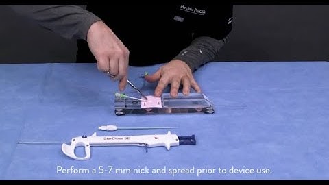 StarClose SE  Vascular Closure System Deployment Video