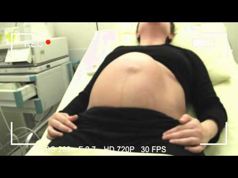 Alien Pregnancy Birth Session 1