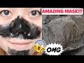 How to get rid of blackheads