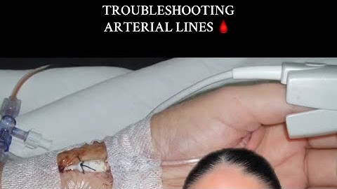 HOW TO TROUBLESHOOT ARTERIAL LINES 🩸