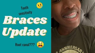 Braces Update | Tooth Sensitivity | Root Canal???
