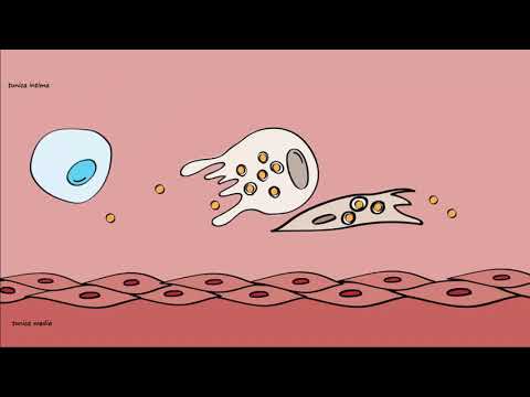 Video: Atherosclerosis Dan Aliran: Peranan Modulasi Epigenetik Dalam Endotelium Vaskular