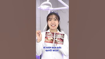 Niềng răng trả góp cho sinh viên thủ tục đơn giản