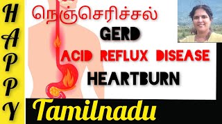 Heartburn | நெஞ்செரிச்சல் | gerd | acid reflux disease | Tamil | happy tamilnadu | perundevi