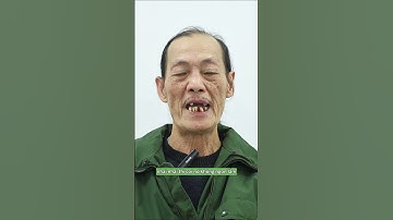 10 năm không đi khám răng và hệ quả khôn lường #nhakhoathuyanh #implant #trongrang