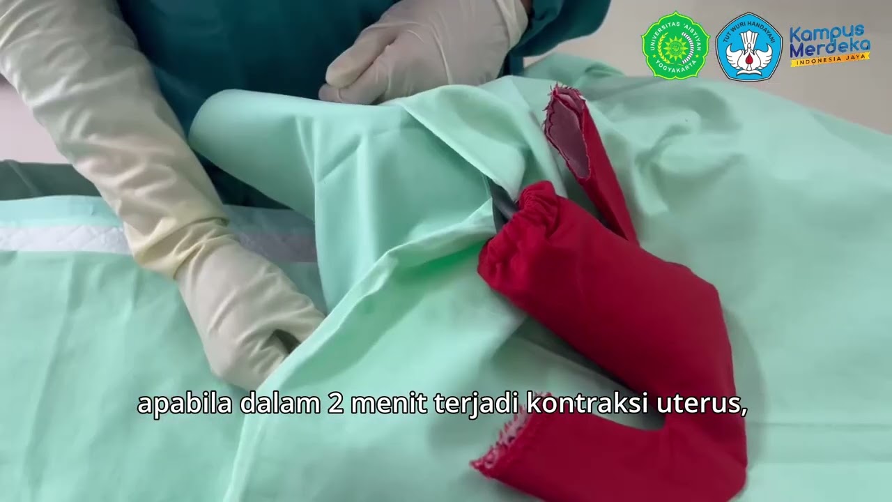 Penanganan Atonia Uteri Dengan Kompresi Bimanual Internal Dan Kompresi Bimanual Eksternal