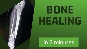 Bone healing in 2 mins!