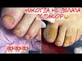 Эксперимент 🙈 🍄 Первый педикюр