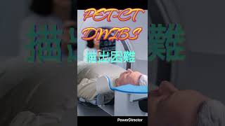 【膵臓がん】発見のカギ“MRCP”とは！？