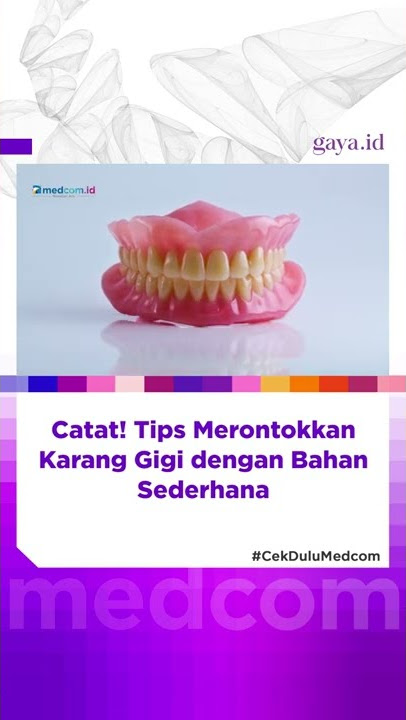 Catat! Tips Merontokkan Karang Gigi dengan Bahan Sederhana