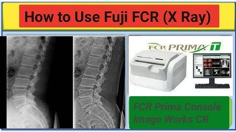 FCR Prima Console Image Works CR, How to use Fuji FCR (X Ray?)