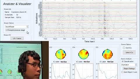 Real-time Automatic Artifact Rejection using REST 2.0