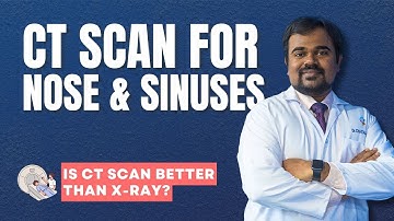 CT scan Nose Sinuses | Sinusitis | Dr. G V K Chaitanya Rao