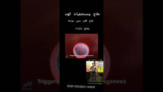 علاج و مستشفيات الهند 00919538314600 علاج_التابعة shorts