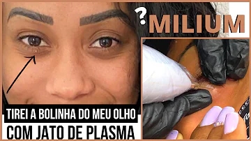 Como chama parte de baixo do olho?