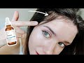 The Ordinary Multi Peptide Serum for Hair Density - 3 Month Update