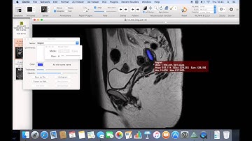 9  How to Annotate Studies in Osirix