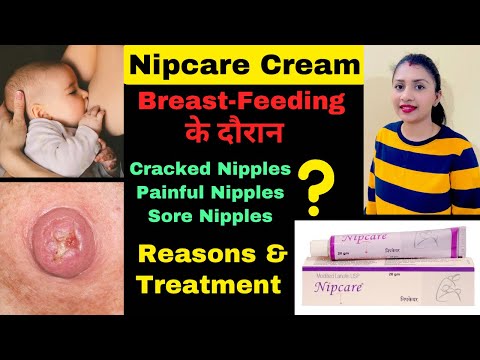 Nipcare Cream Review | ब्रेस्ट-फ़ीडिंग के दौरान होने वाले निपल crack,soreness के reasons & Treatment