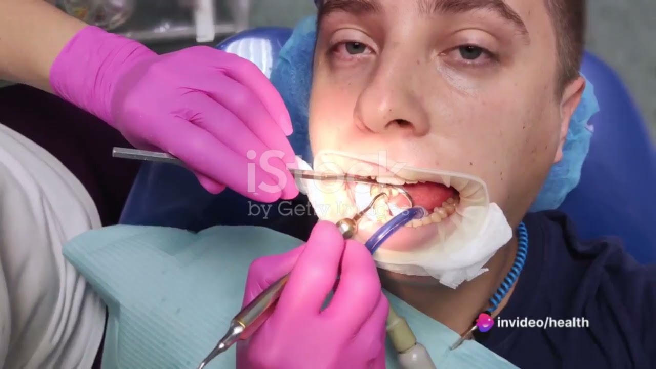 DentaFend Reviews: Does It Work? Real Consumer Warning Alert