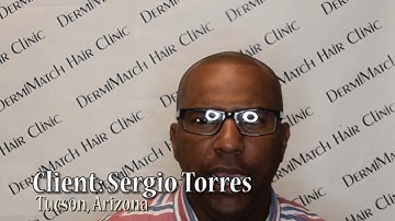 Scalp Micropigmentation - Arizona (black)