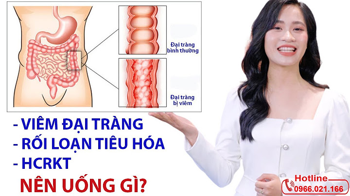 Men tiêu hóa hỗ trơ bệnh viêm ruột kích thích năm 2024