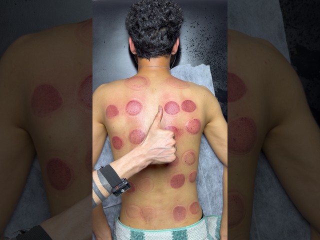 asmr wow cupping😍🔥#shorts #asmr