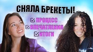 СНЯЛА БРЕКЕТЫ! Процесс, итоги и впечатления.. Завершение серии "Брекеты в 30 лет"