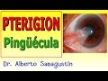 PTERIGION y PINGUÉCULA ocular