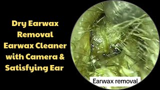 Dry Earwax Removal Earwax Cleaner with Camera &amp; Satisfying Ear Care