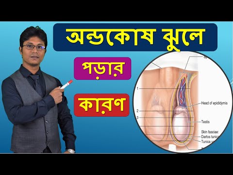 Causes of Scrotal Sagging | Scrotum low down - Dr Shamim Hosen
