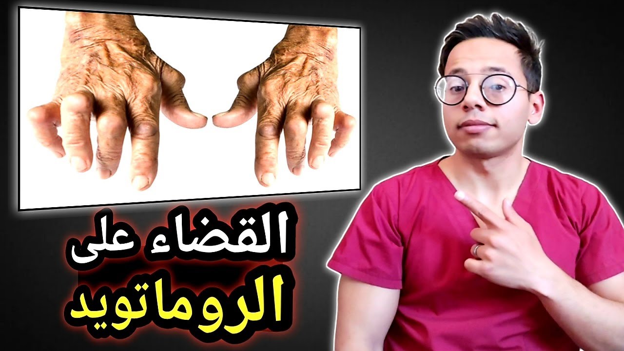 كيف تتخلص من إلتهاب المفاصل الروماتويدي للأبد وبدون أدوية