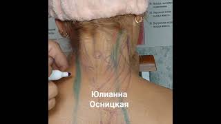 картинка: РЕМЕННЫЕ МЫШЦЫ