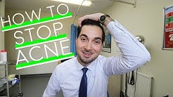 How To Get Rid of Acne | Best Spot Treatment | How To Use Benzoyl Peroxide | Prevent Acne (2018)