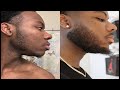 How to Grow a Beard | Minoxidil + Beard Journey