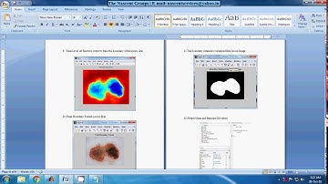 A Novel Approach to Segment Skin Lesions in Dermoscopic Images Based on a Deformable Model