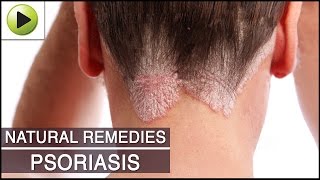Skin Care - Psoriasis - Natural Ayurvedic Home Remedies screenshot 3
