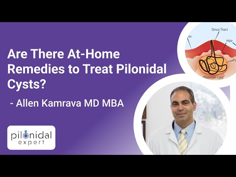 Video: 3 Ways to Treat Pilonidal Cysts