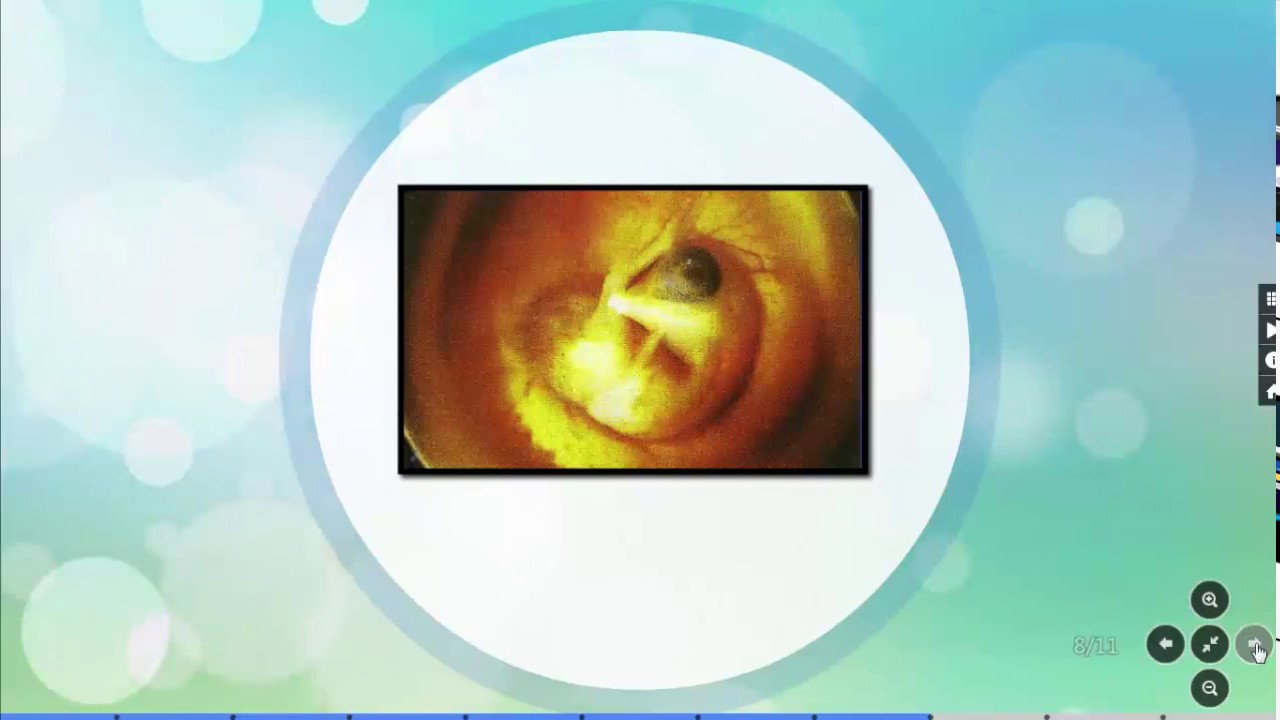 مراحل تحول جنين البيضة الى دجاجة - Chicken Embryo Development