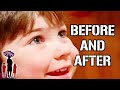 Best BEFORE and AFTER Successful Stories | Compilation | Supernanny