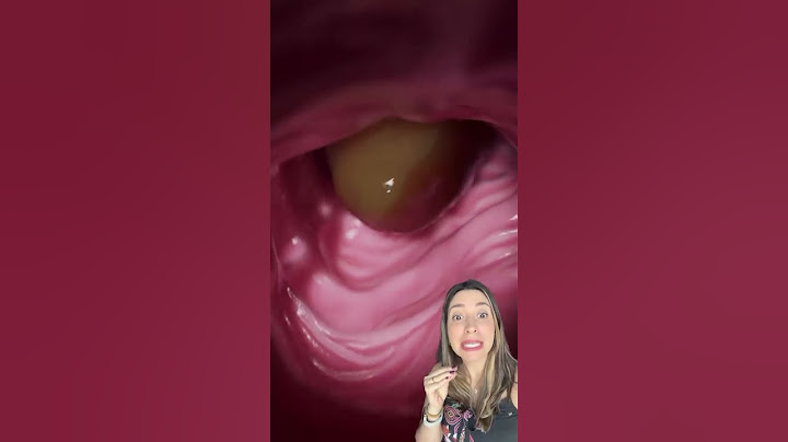 Como as fezes são formadas? 💩