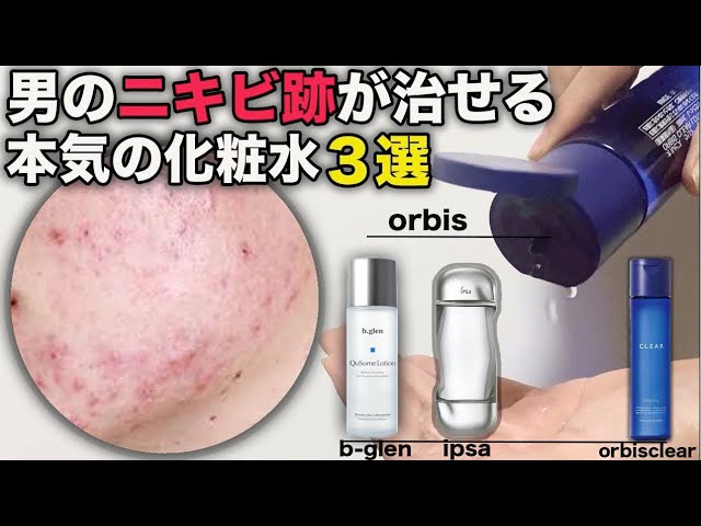 ニキビ跡を治す化粧水 3選 色素沈着 肌荒れ改善 Youtube