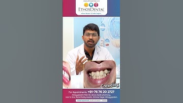 How Long Does Clip Treatment Take? | Dr. Naresh Kumar | Ethos Dental Clinic, Visakhapatnam
