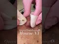 【毛穴エクストラクション】メンズのいちご鼻