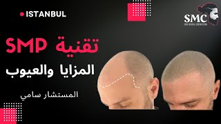 تقنية محاكاة الشعر المزايا والعيوب  SMP