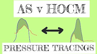 Aortic Stenosis Versus Hocm Pressure Tracings